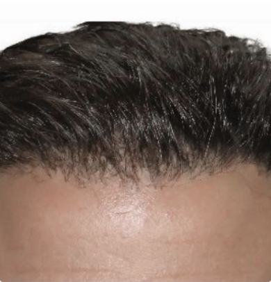 Natural Looking Results