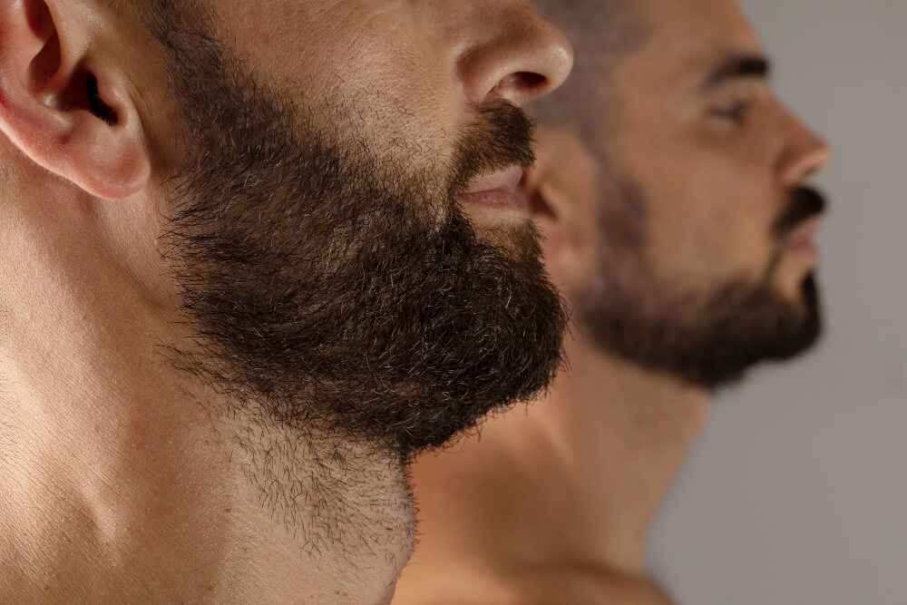 two men with full grown beard